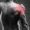 shoulder conditions - fast and fit physical therapy