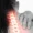 Spine Conditions - Fast and Fit Physical Therapy